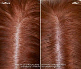 Biolage Scalp Sync Calming Shampoo